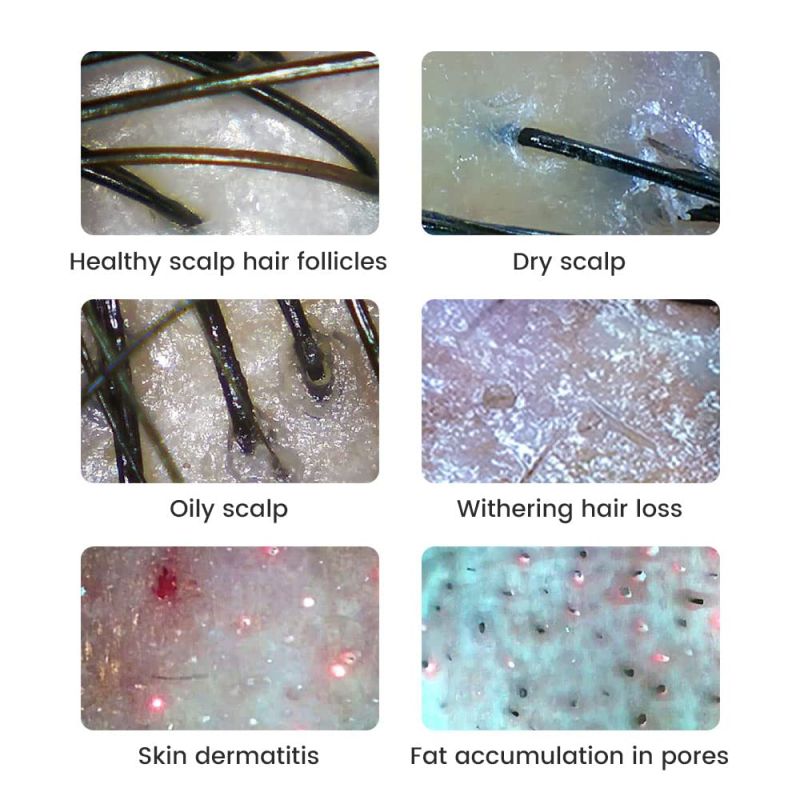 Microscope Numérique 500X | Réparation Électronique, Peau, Pièces de Monnaie | Vidéo 1080P | Portable Dermatoscope