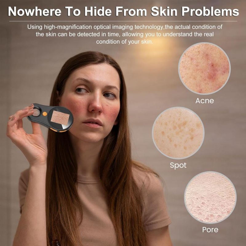 Microscope Numérique 500X | Réparation Électronique, Peau, Pièces de Monnaie | Vidéo 1080P | Portable Dermatoscope