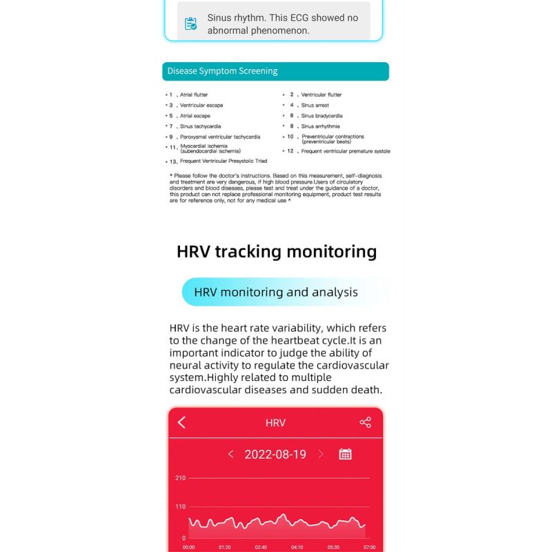 EP01 Montre Connectée Smartwatch Santé ECG PPG Glycémie Température FC Sommeil Sport Fitness Tracker HD 1.47