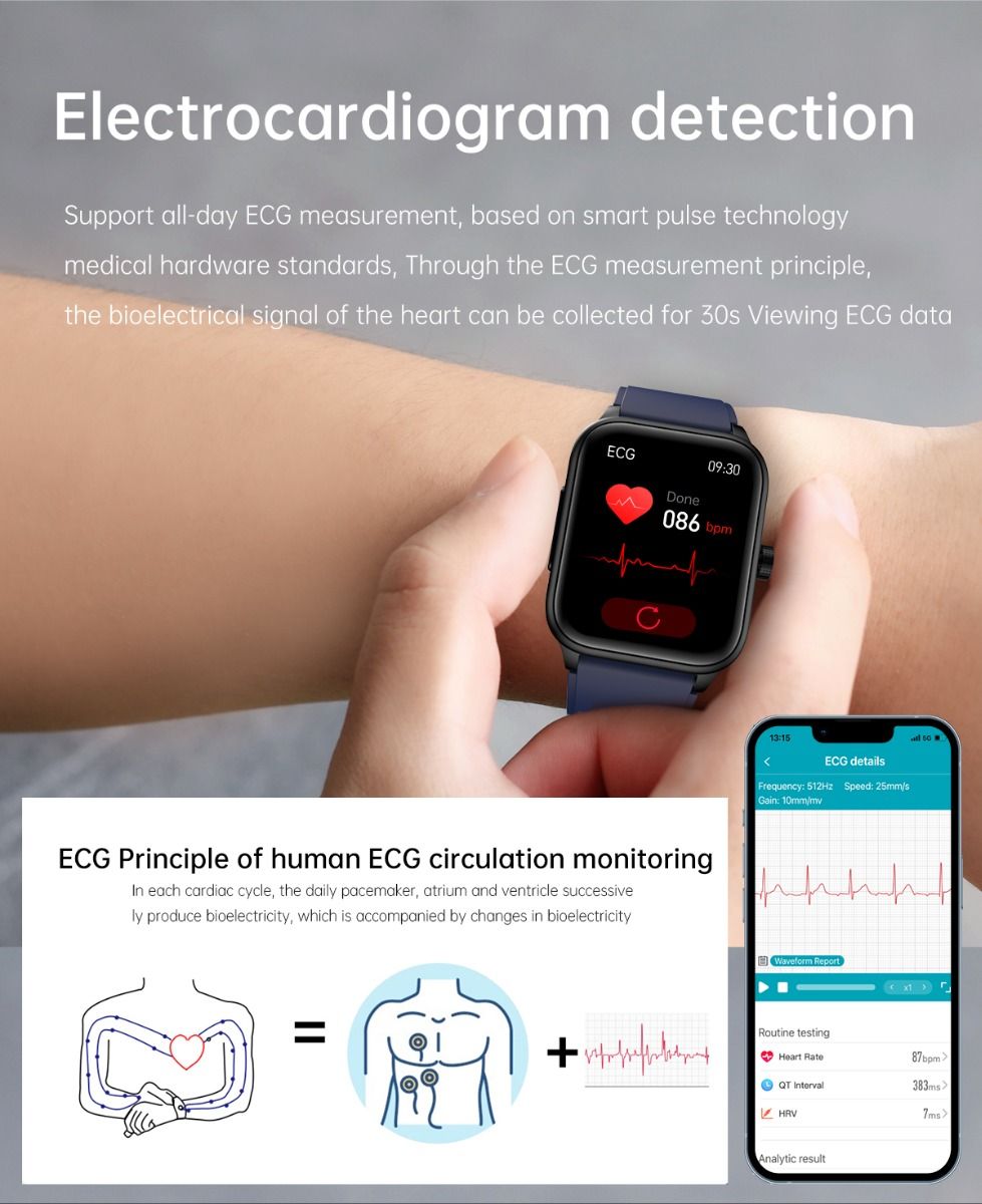 ET540 Glycémie ECG Température corporelle Tension artérielle Oxygène dans le sang Fréquence cardiaque Appel Bluetooth Smartwatch Fitness Tracker