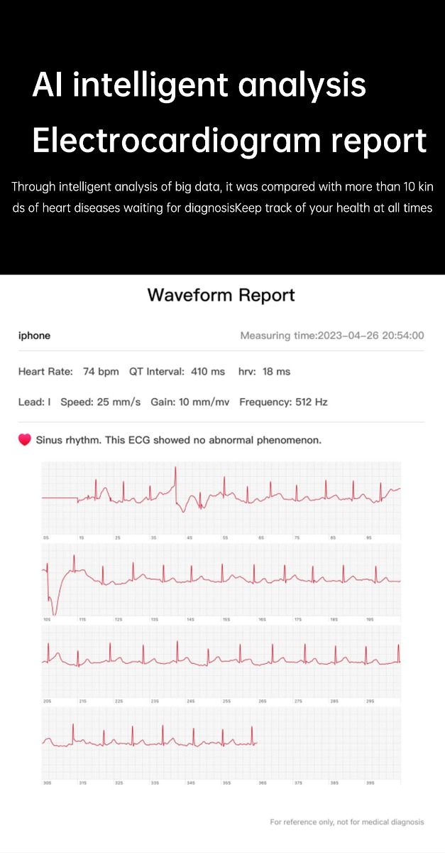 ET540 Glycémie ECG Température corporelle Tension artérielle Oxygène dans le sang Fréquence cardiaque Appel Bluetooth Smartwatch Fitness Tracker