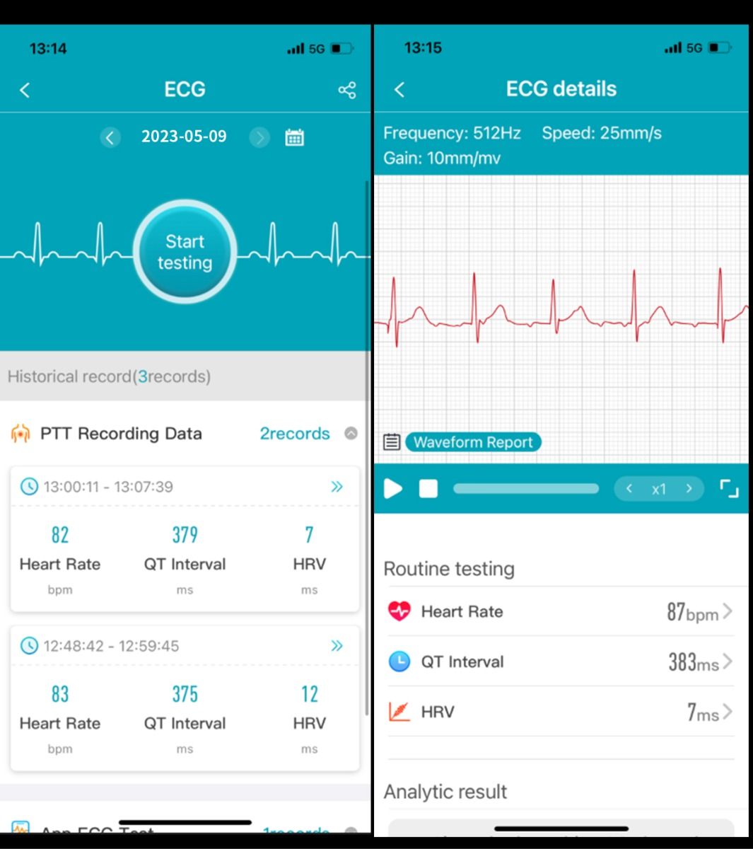 ET540 Glycémie ECG Température corporelle Tension artérielle Oxygène dans le sang Fréquence cardiaque Appel Bluetooth Smartwatch Fitness Tracker