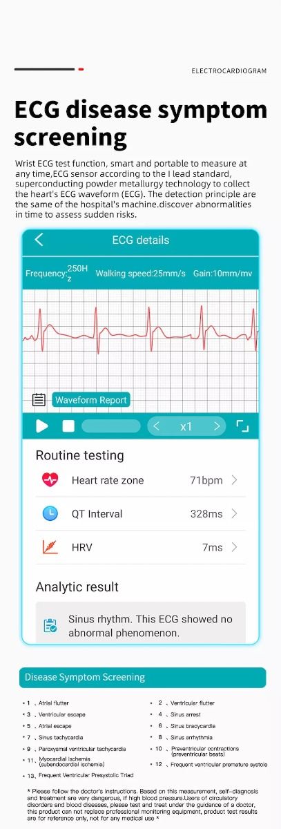 EP02 Smart Watch Glycémie ECG PPG Température Fréquence Cardiaque IPS HD Étanche Fitness Tracker Sommeil/HRV