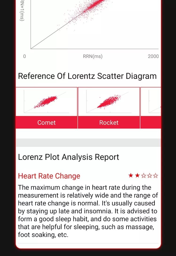 EP02 Smart Watch Glycémie ECG PPG Température Fréquence Cardiaque IPS HD Étanche Fitness Tracker Sommeil/HRV